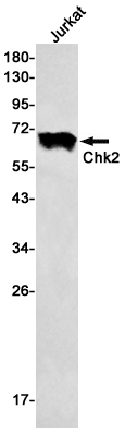 Chk2