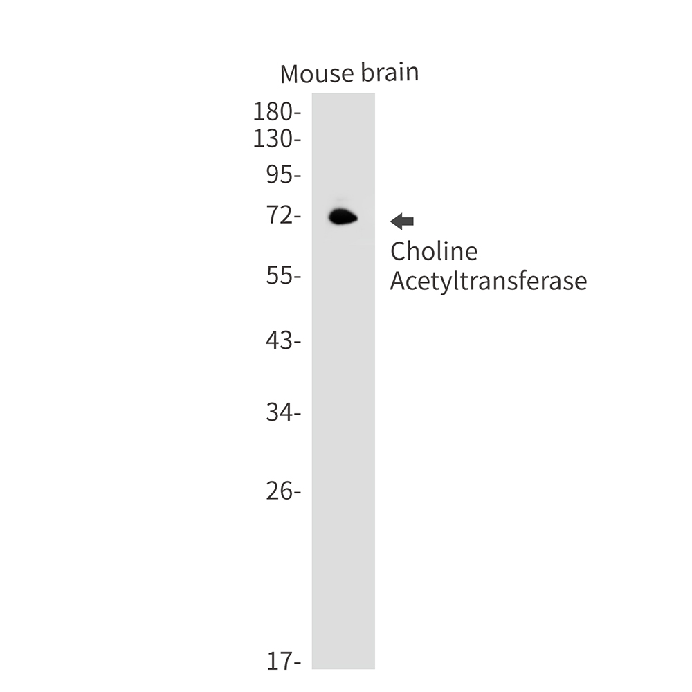 Choline Acetyltransferase