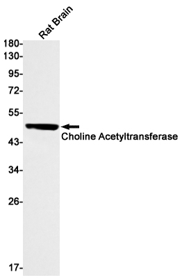 Rabbit Monoclonal Antibody to Choline Acetyltransferase