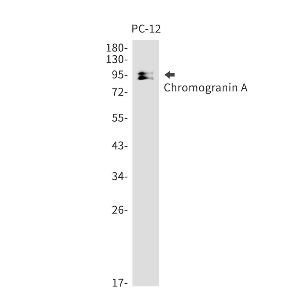 Chromogranin A