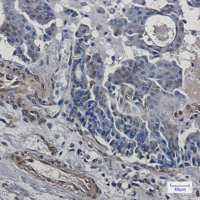Rabbit Monoclonal Antibody to CIP4