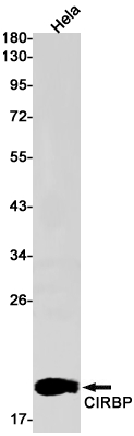 CIRBP