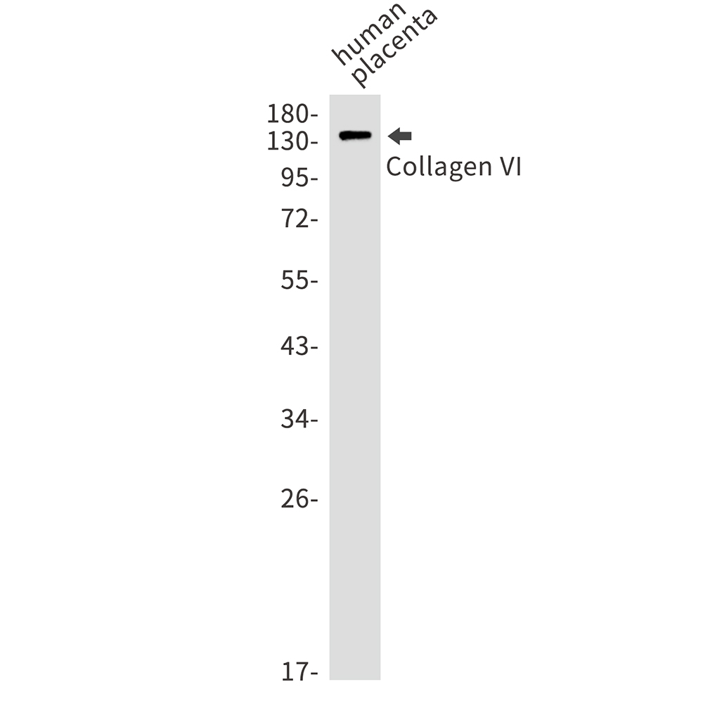 Collagen VI alpha 1