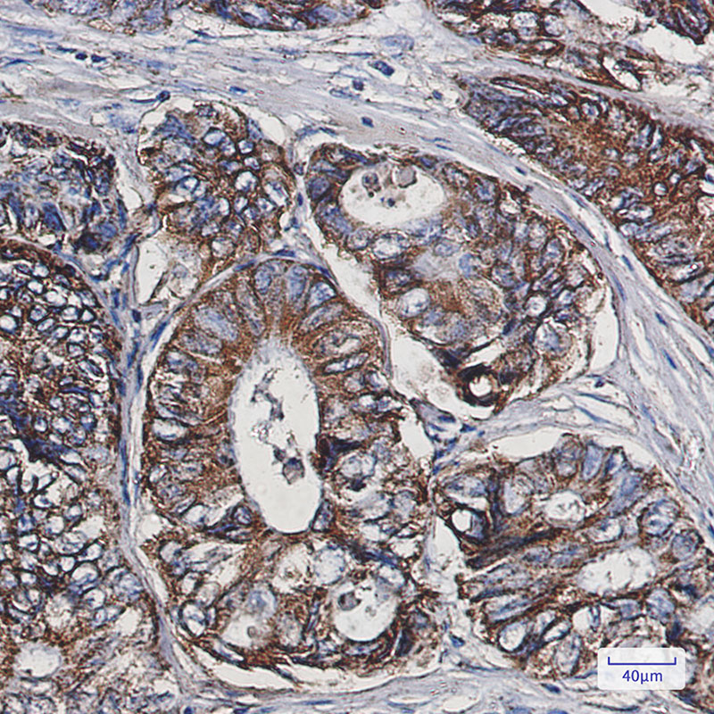Rabbit Monoclonal Antibody to Cpn10