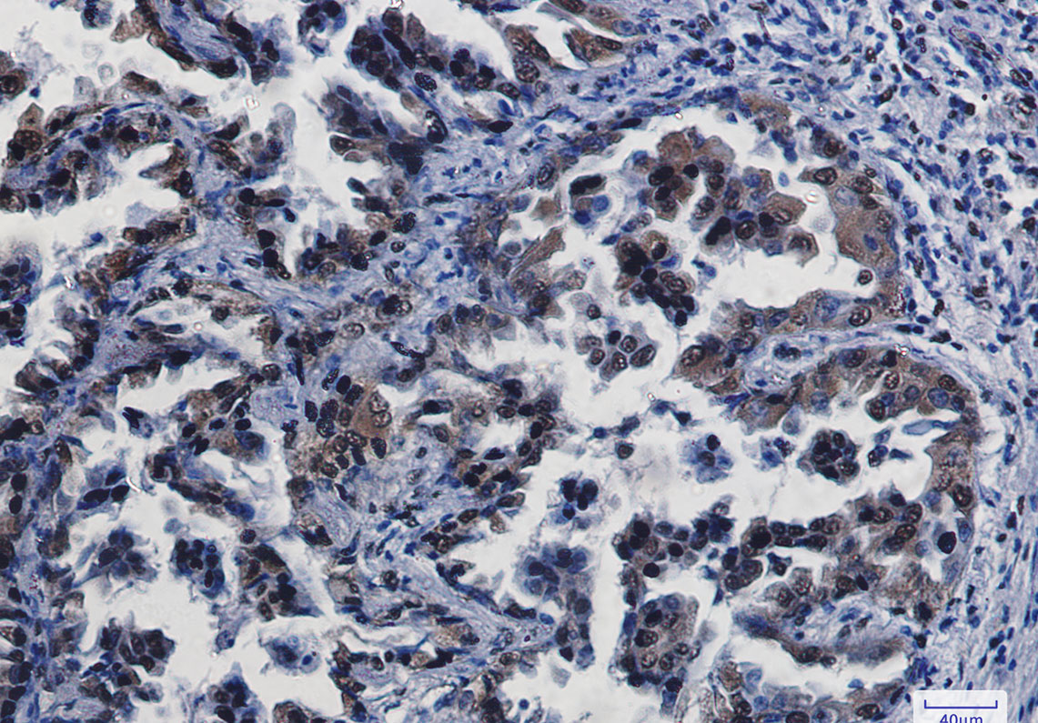 Rabbit Monoclonal Antibody to CREB