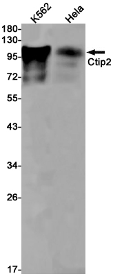 Ctip2