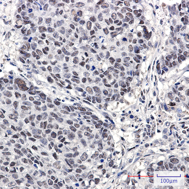 Rabbit Monoclonal Antibody to Cullin 4A/4B