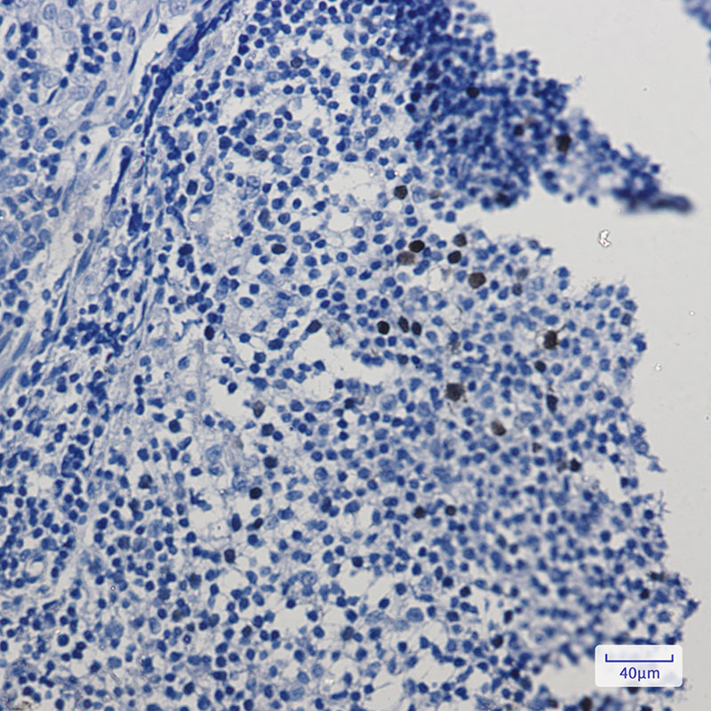 Rabbit Monoclonal Antibody to Cyclin A2