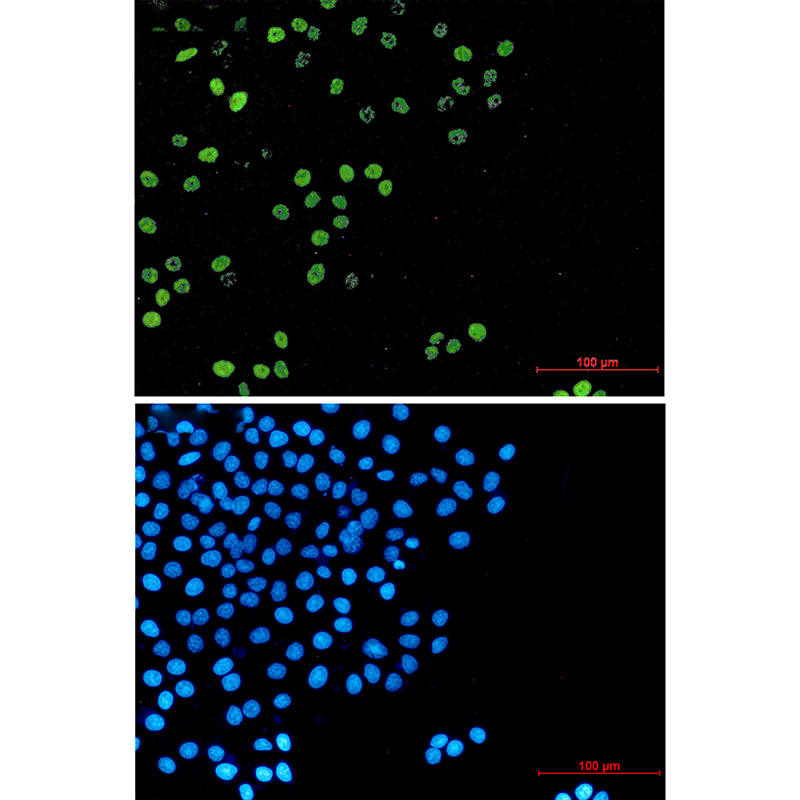 Rabbit Monoclonal Antibody to Cyclin A2