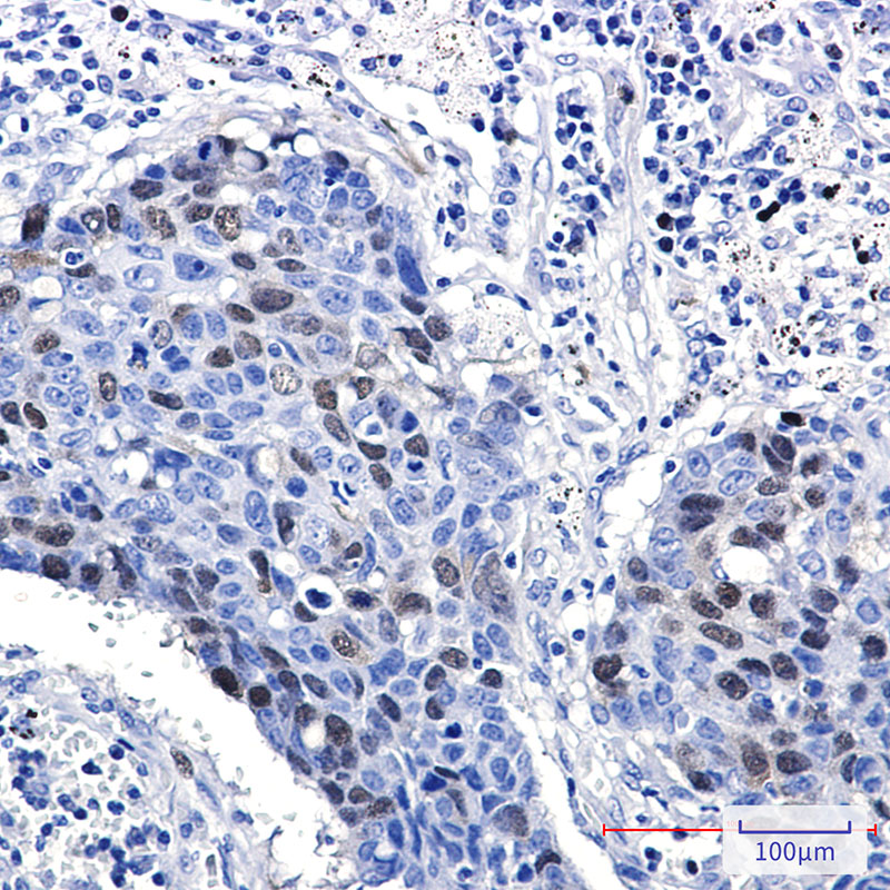 Rabbit Monoclonal Antibody to Cyclin A2