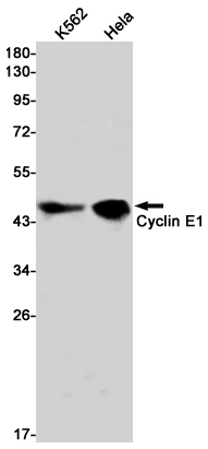 Cyclin E1