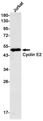 Cyclin E2