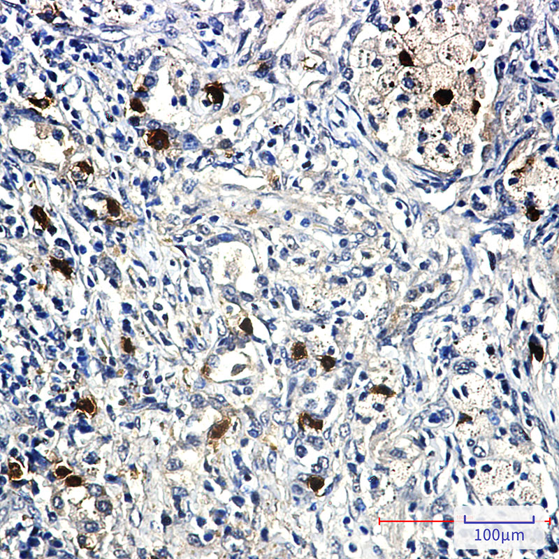 Rabbit Monoclonal Antibody to Cyclin E2