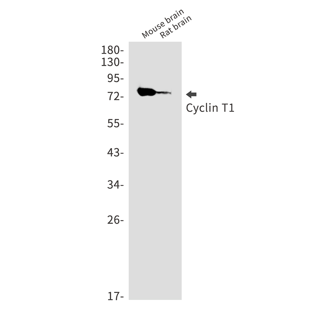 Cyclin T1