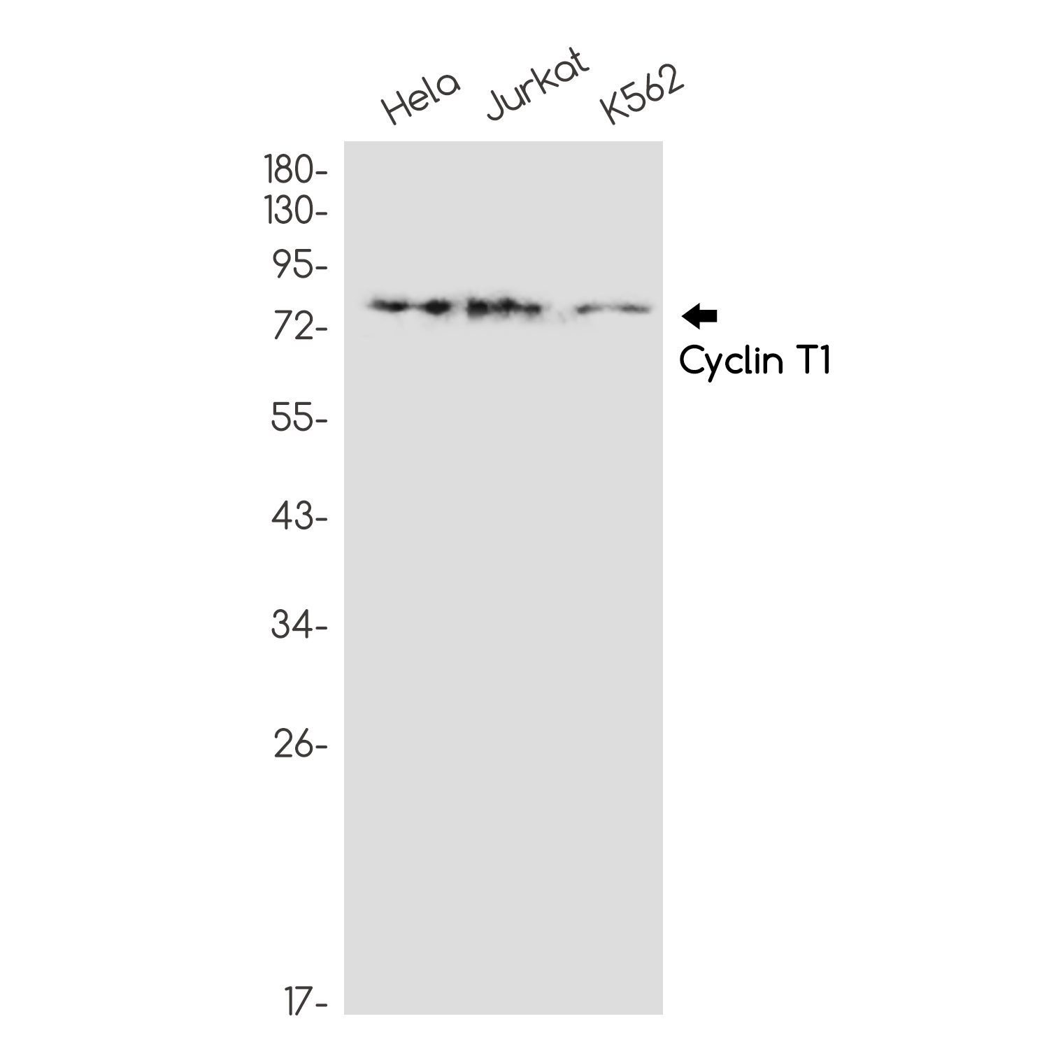 Rabbit Monoclonal Antibody to Cyclin T1