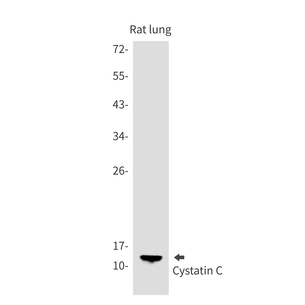 Cystatin C