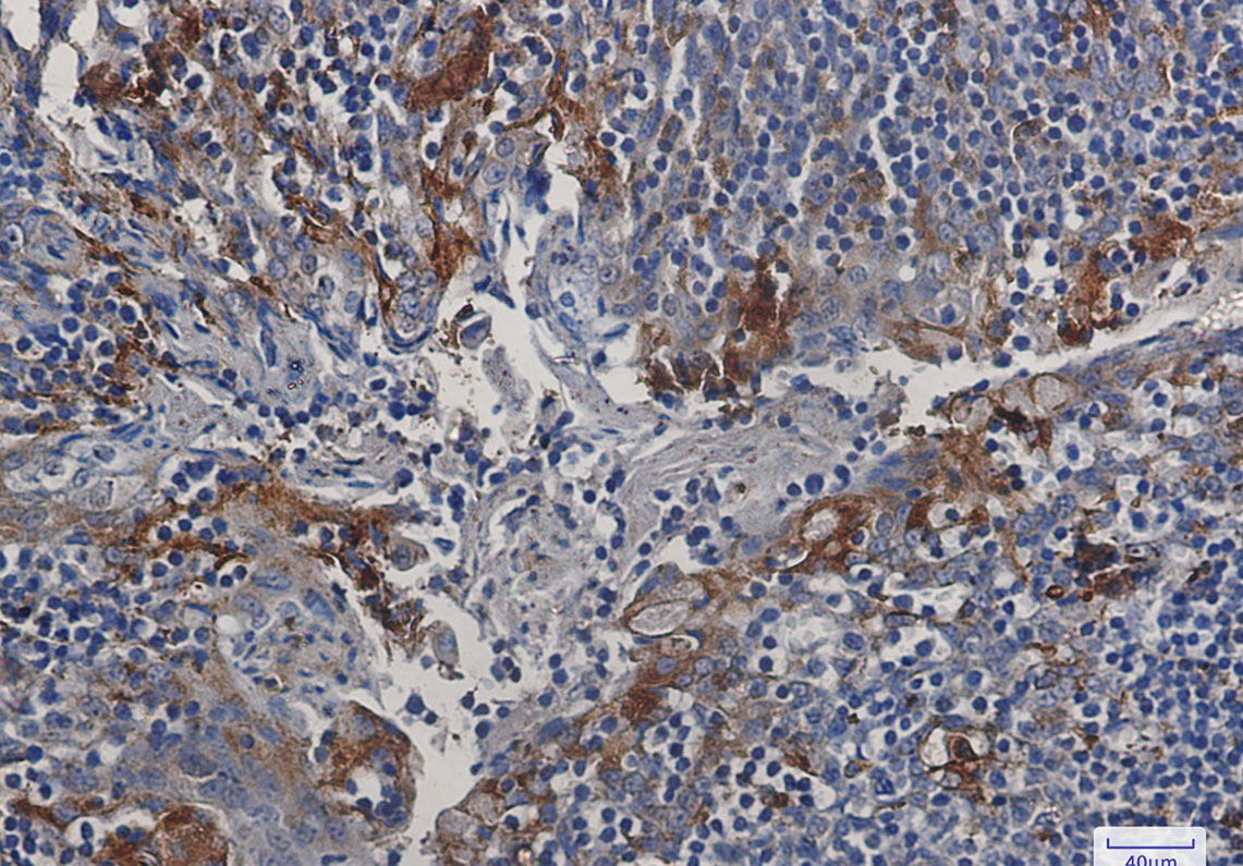 Rabbit Monoclonal Antibody to Cystatin C