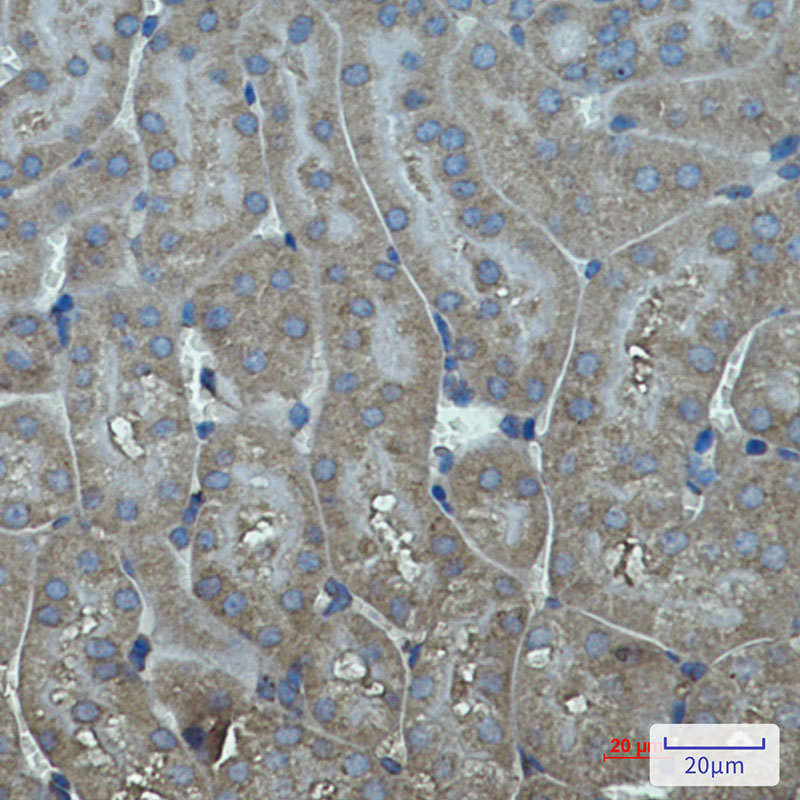 Rabbit Monoclonal Antibody to Cytochrome P450 17A1