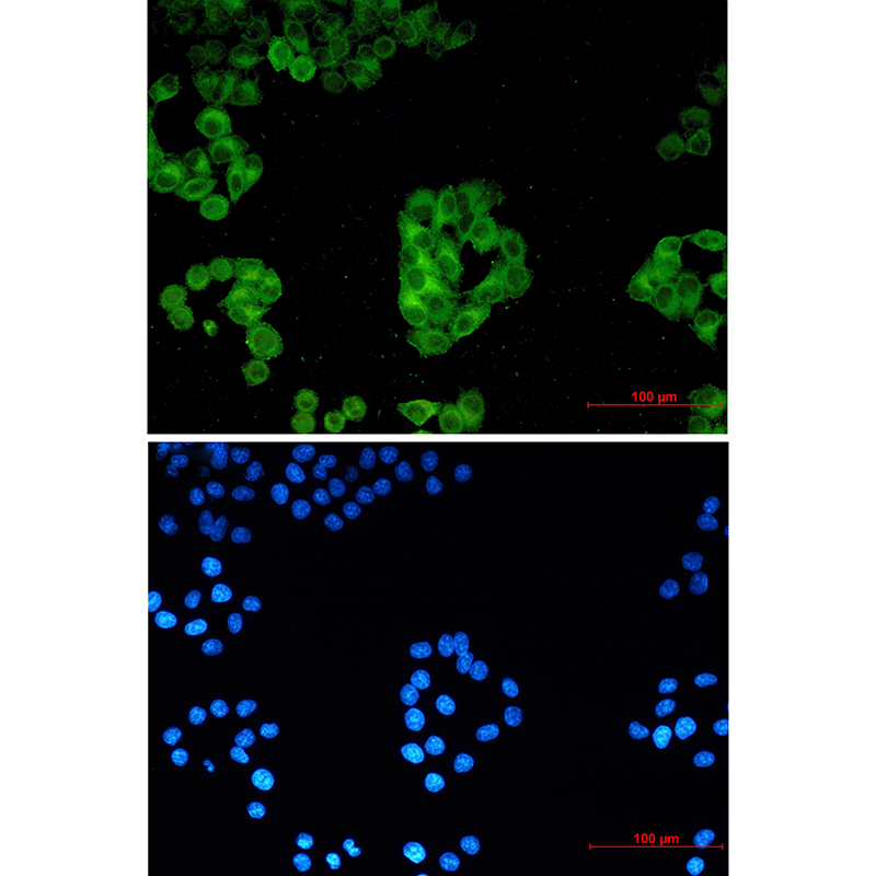 Rabbit Monoclonal Antibody to Cytochrome P450 Reductase