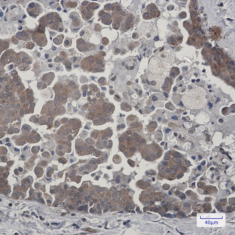 Rabbit Monoclonal Antibody to Cytochrome P450 Reductase