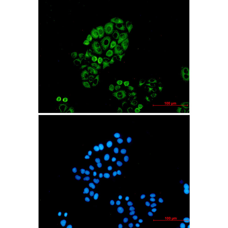 Rabbit Monoclonal Antibody to Cytokeratin 18
