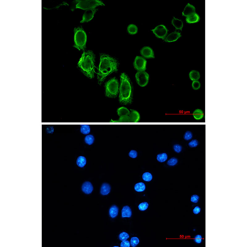Rabbit Monoclonal Antibody to Cytokeratin 19