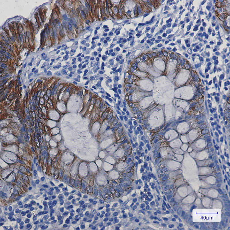 Rabbit Monoclonal Antibody to Cytokeratin 19