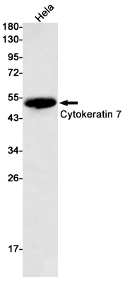 Cytokeratin 7