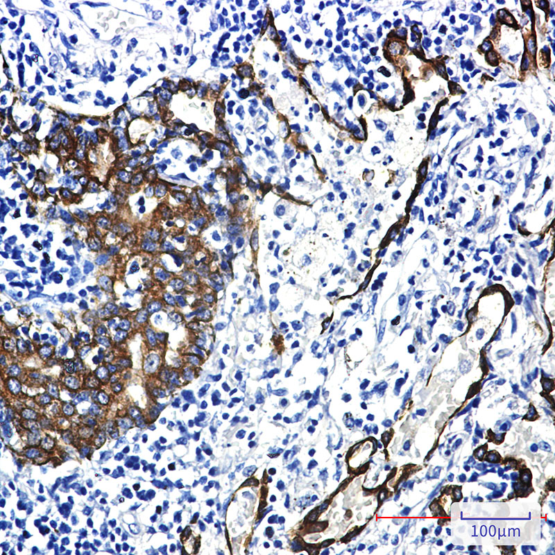 Rabbit Monoclonal Antibody to Cytokeratin 7