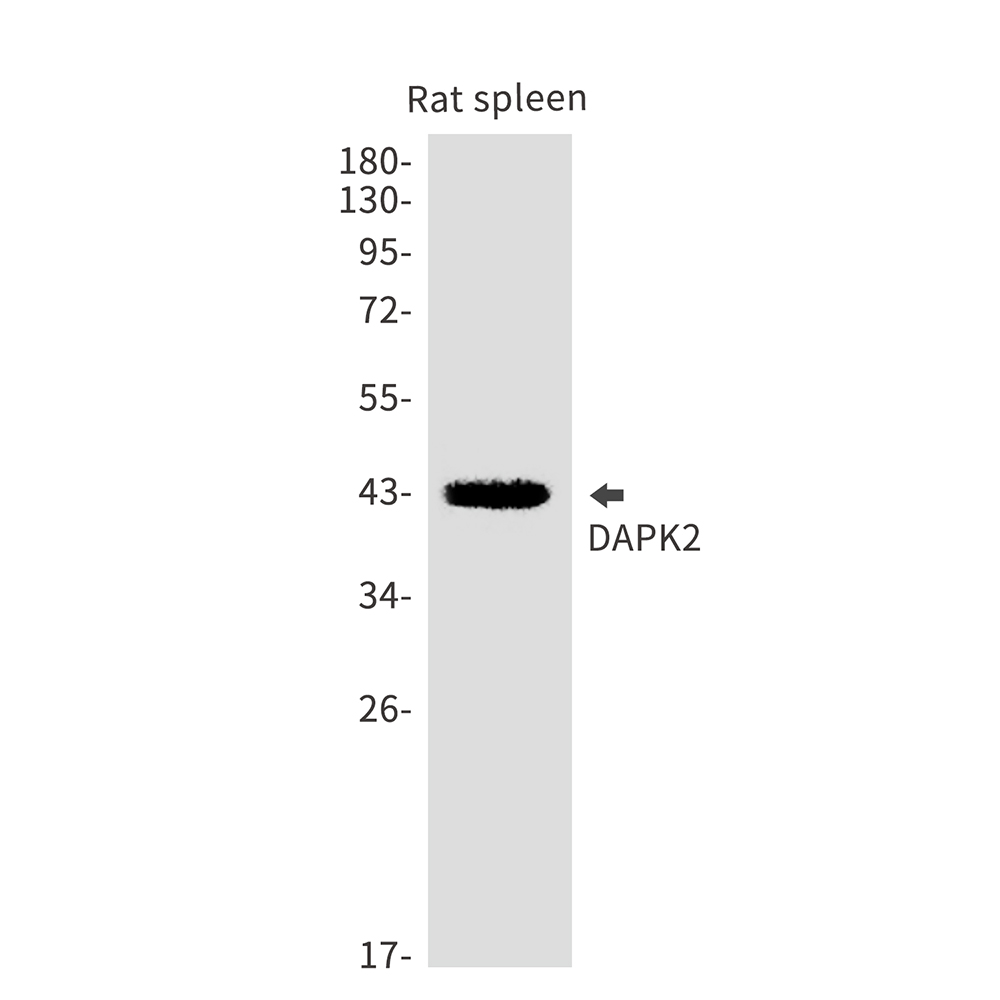 DAPK2