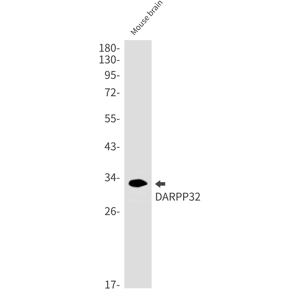 DARPP32