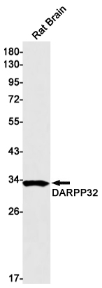 Rabbit Monoclonal Antibody to DARPP32