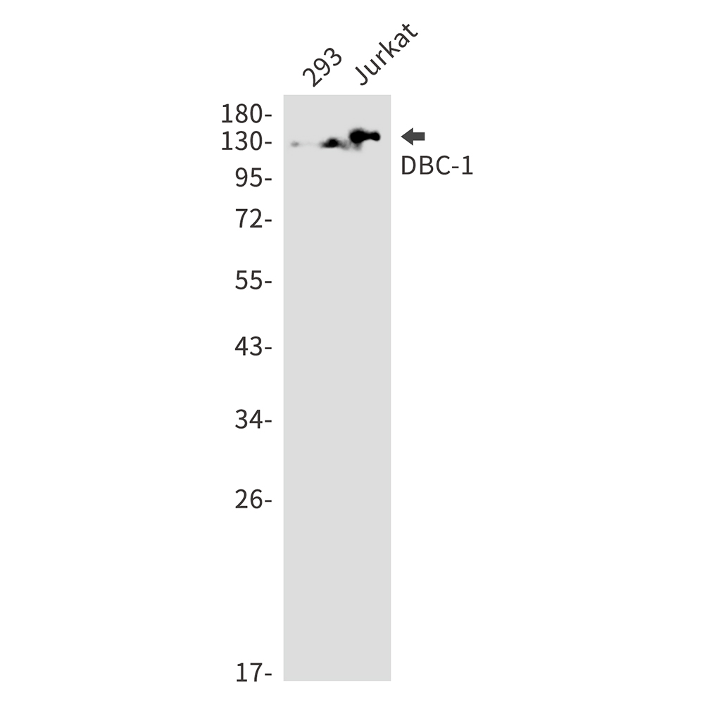 DBC 1