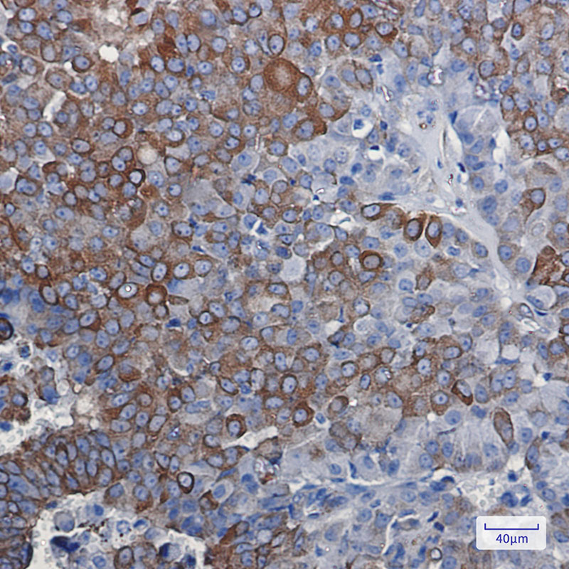Rabbit Monoclonal Antibody to DCAMKL1