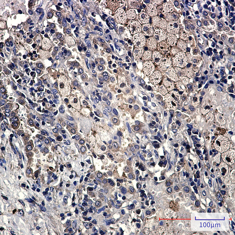 Rabbit Monoclonal Antibody to DcR2