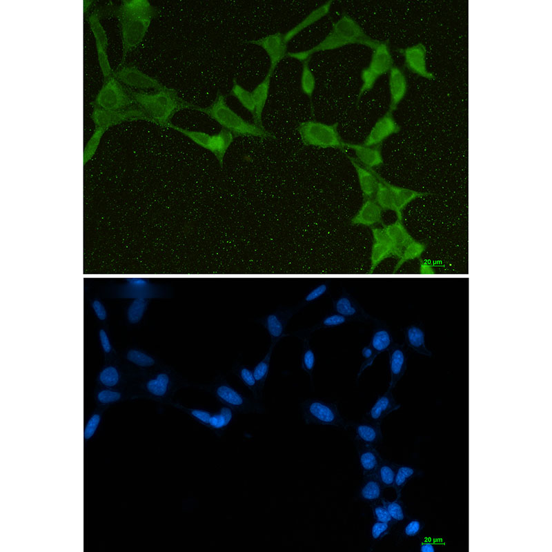 Rabbit Monoclonal Antibody to DDX21