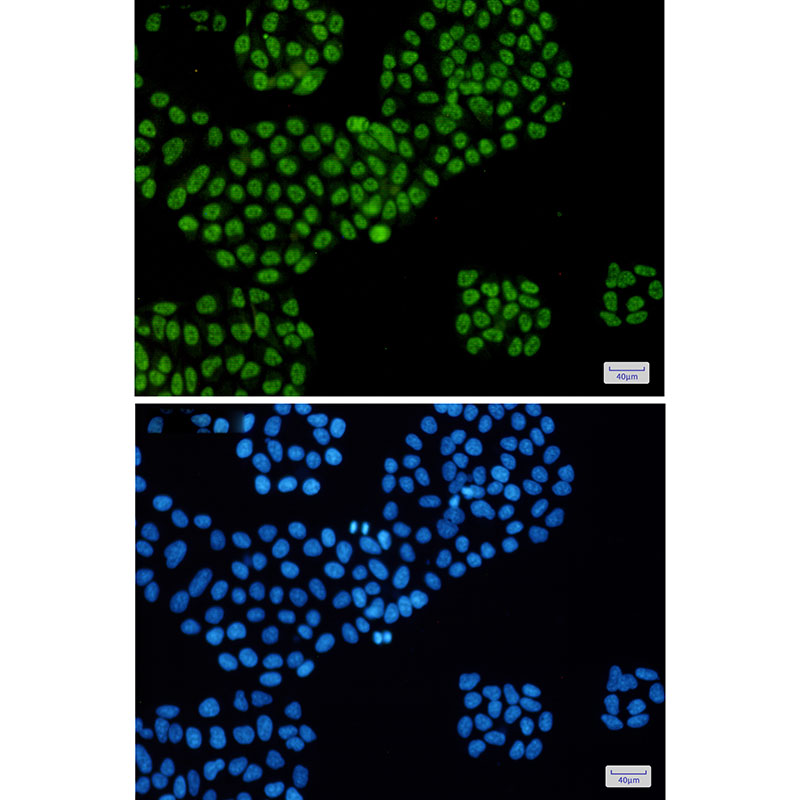 Rabbit Monoclonal Antibody to DDX5