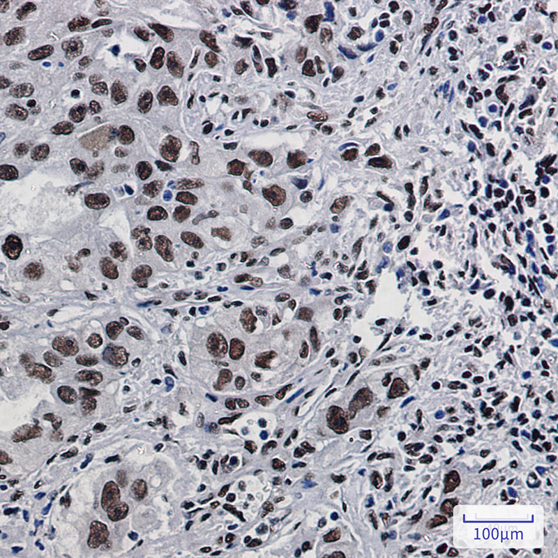 Rabbit Monoclonal Antibody to DDX5