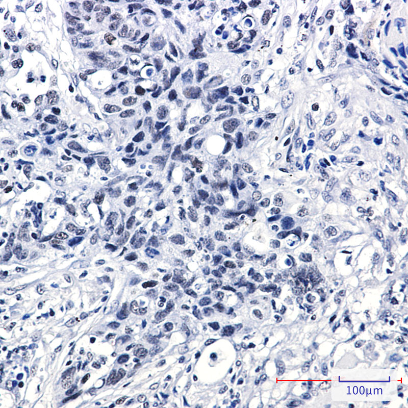 Rabbit Monoclonal Antibody to DEK