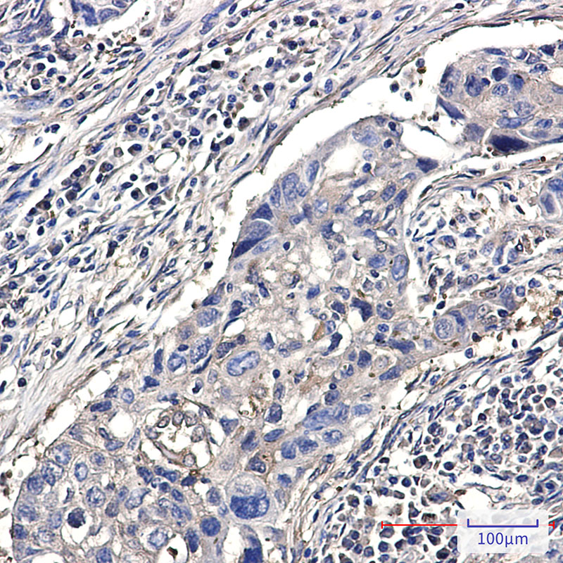 Rabbit Monoclonal Antibody to Destrin