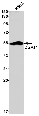 DGAT1