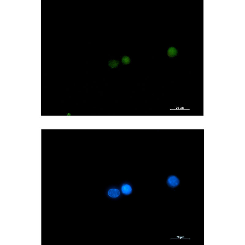 Rabbit Monoclonal Antibody to DGCR8