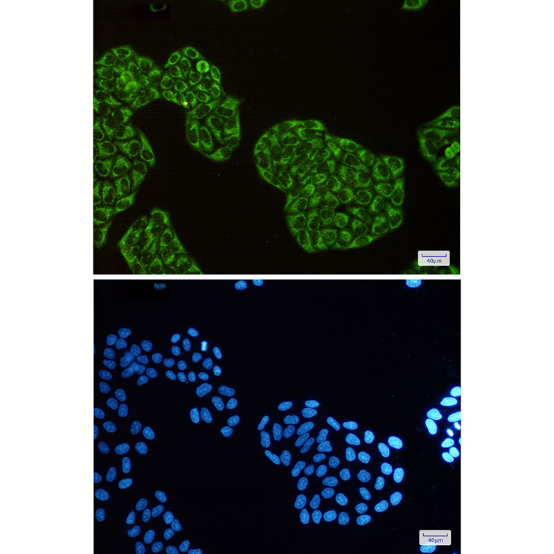 Rabbit Monoclonal Antibody to DISC1