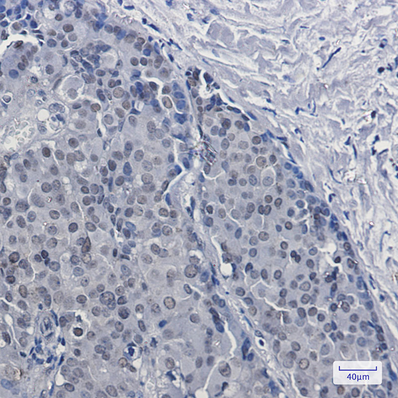 Rabbit Monoclonal Antibody to DKC1