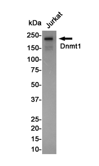 Dnmt1
