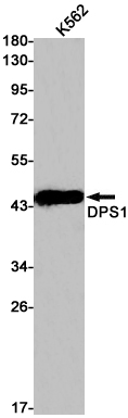 DPS1