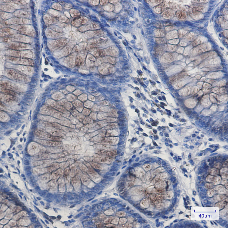 Rabbit Monoclonal Antibody to DYNLL1