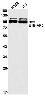 E1B AP5