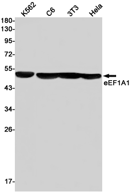 Elongation Factor 1A1