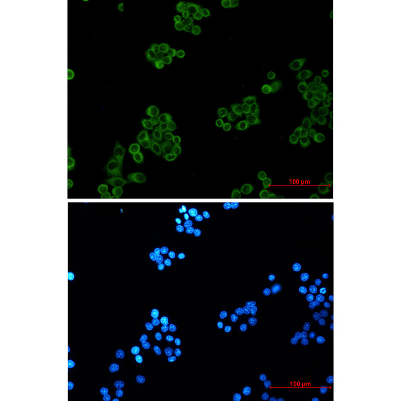 Rabbit Monoclonal Antibody to EHD1